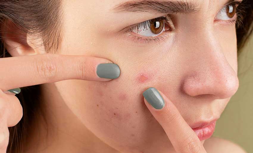 Dr. Yeung Ho Hong(楊浩康) explains isotretinoin